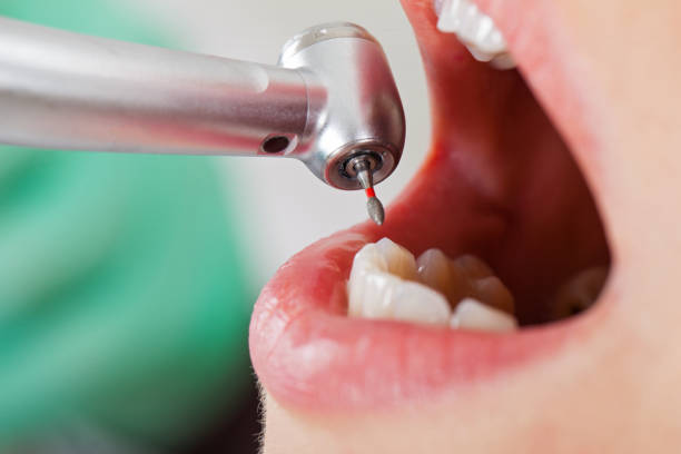 Best Emergency Treatment for Dental Infections or Abscesses in Pacific, MO